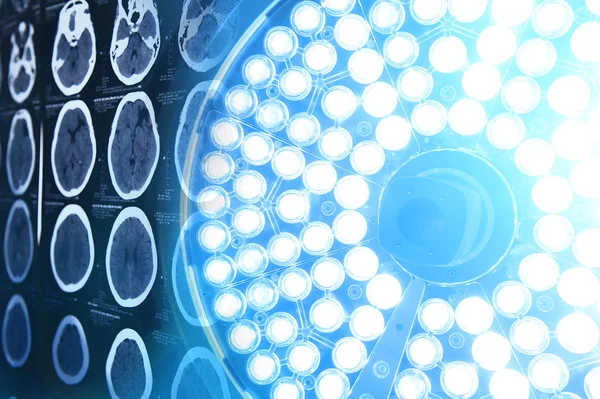 Beyin Cerrahi Lambalar Operasyon Odasında Bir Bilgisayarlı Tomografi Görüntüleri — Stok fotoğraf