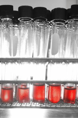 Hastanedeki laboratuvarda yapılan kan testleri seçici renk tekniği ve sanat ışıklandırmasıyla yapılıyor. 