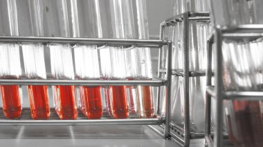 Hastanedeki laboratuvarda yapılan kan testleri seçici renk tekniği ve sanat ışıklandırmasıyla yapılıyor. 