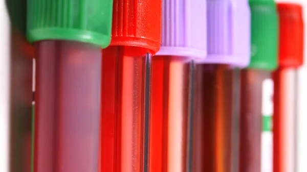 Close Blood Test Tube Background — Stock Photo, Image