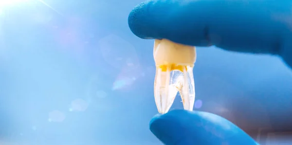 Стоматолог Тримає Зуби Вид Крупним Планом — стокове фото