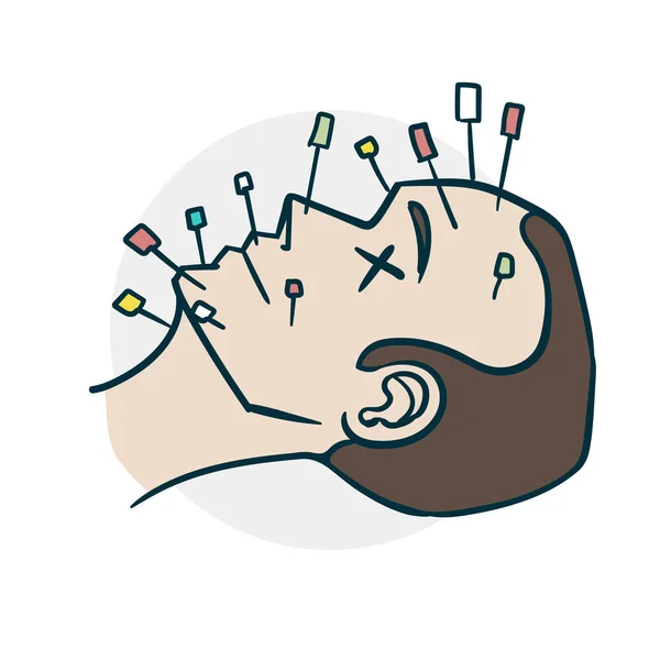Procedimiento de acupuntura en el estilo de los cómics faciales — Vector de stock