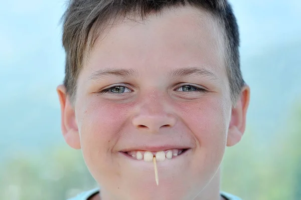 Portret van een jongen met zijn neus peeling van zonnebrand — Stockfoto