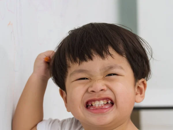 Close-up of little boy smiling at dental caries — Stock Photo, Image