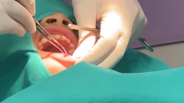 Tandläkaren Injicerar Bedövningsmedel Till Liten Pojke — Stockvideo