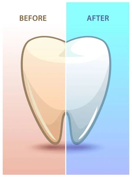 Карикатурные зубы до и после отбеливания . — стоковый вектор