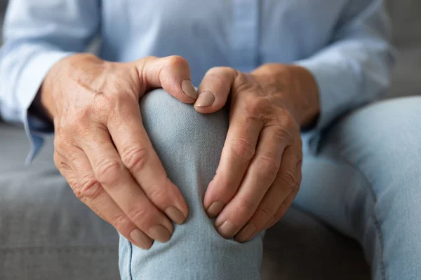 Old woman touching knee feeling pain suffering from osteoarthritis, closeup — Stock Photo, Image