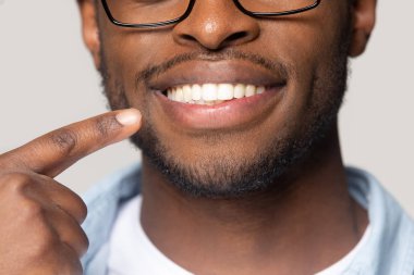 Yakından bakınca Afrikalı adam beyaz dişli gülümsemeyi işaret ediyor.