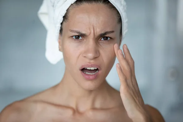 Woman touches face feels stressed about first mimic wrinkles