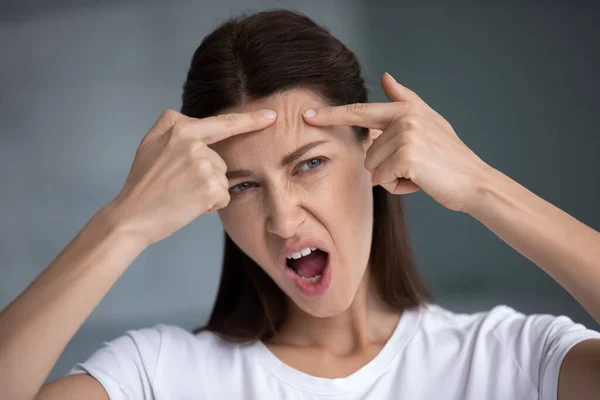 Angry woman looks in mirror squeezes pimple on forehead — Stock Photo, Image