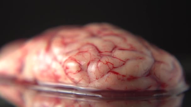 Cerebro Concepto Apoyo Para Estudio Drogas Antidepresivos Psicología Psicoterapia Así — Vídeo de stock