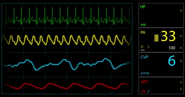 Looped Monitor Del Paciente Muestra Signos Vitales Ecg Electrocardiograma Ekg — Vídeos de Stock