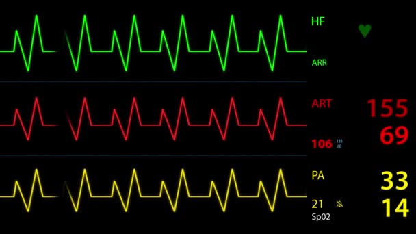 Schleife Patientenmonitor Zeigt Vitalzeichen Wie Elektrokardiogramm Sauerstoffsättigung Spo2 Und Atmung — Stockvideo