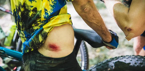 Cyklista spadl z jeho kolo. — Stock fotografie