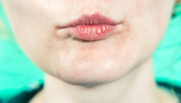 Tirantes. La chica con frenos sonríe. Erudito verde — Foto de Stock