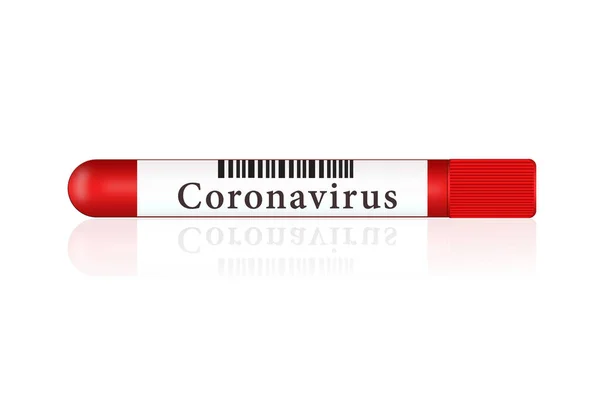 Tube Essai Sur Fond Blanc Avec Résultat Coronavirus 2019 Nkov — Photo