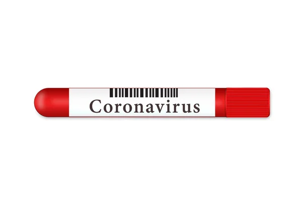Тестова Трубка Білому Тлі Результатом Коронавірусу 2019 Року Концепція Пандемічної — стокове фото