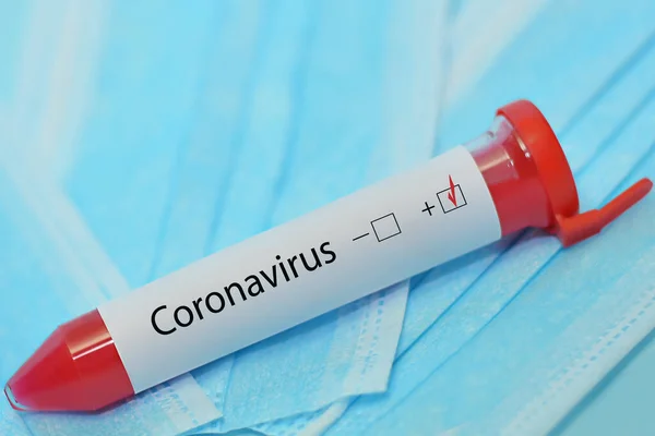 Coronavirus 2019 Ncov Tubo Ensayo Con Sangre Identificado Por Coronavirus —  Fotos de Stock