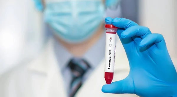 Close-up doctor\'s hand with positive blood test for a new fast-spreading coronavirus originating from Wuhan, China