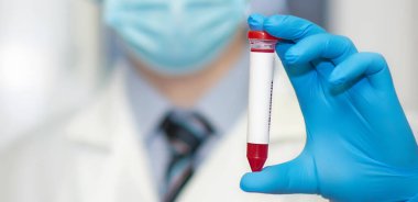 Doktorun eli, test tüpünü kanla tutuyor.