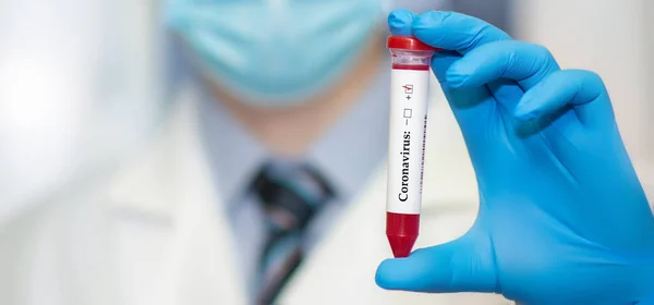 Рука Близького Лікаря Позитивним Аналізом Крові Нового Швидкого Розповсюдження Коронавірусу — стокове фото