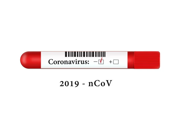 2019 Nkov Coronavirüs Negatif Sonuçlarıyla Beyaz Zemin Üzerinde Test Tüpü — Stok fotoğraf