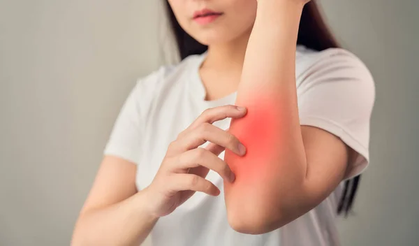 Kobieta Dotyka Łokcia Przewlekłego Reumatyzmu Stawów Jest Tak Wiele Cierpienia — Zdjęcie stockowe