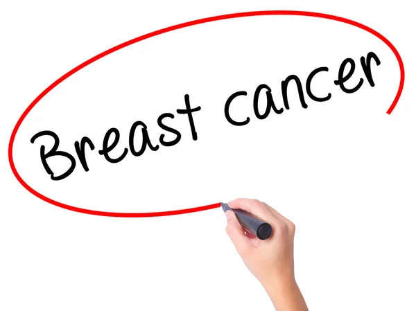 Женщины вручную пишут рак молочной железы с черным маркером на визуальном снимке — стоковое фото