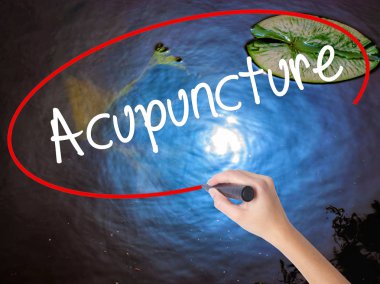 Kadın el yazma akupunktur şeffaf domuz üzerinde marker ile