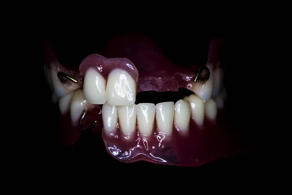 Zubní Proužky Černém Pozadí Tapety — Stock fotografie