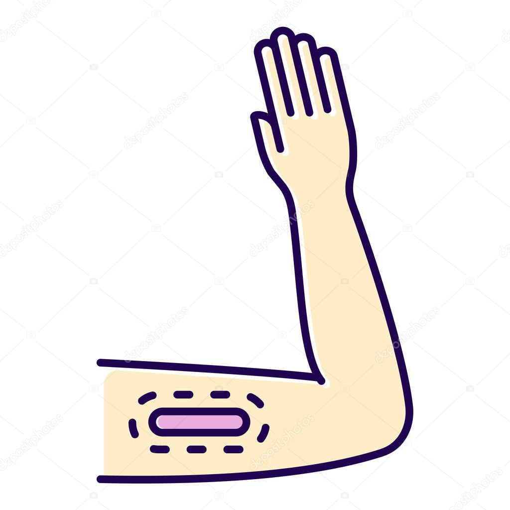 Contraceptive implant color icon. Female preservative method. Unplanned pregnancy prevention, birth control method with medical procedure. Underskin input on arm. Isolated vector illustration