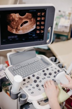 Doktorlar özel bir klonda ultrason cihazı kullanıyorlar.