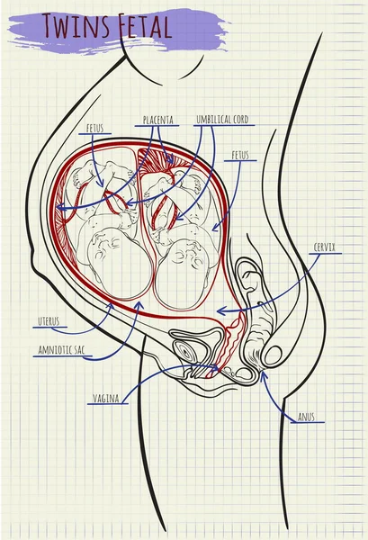 図 amniotik 袋双子 — ストックベクタ