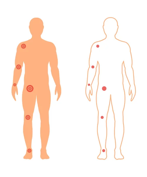 Ανδρική σιλουέτα με ένα επώδυνες αρθρώσεις. Εικονογράφηση διάνυσμα. — Διανυσματικό Αρχείο