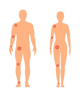 Ağrılı eklem ile erkek ve dişi siluet. Vektör illustr