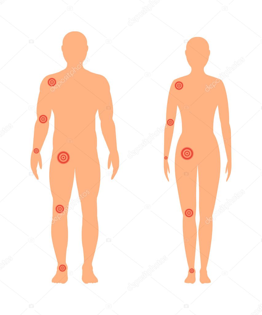 Male and female silhouette with a painful joints. Vector illustr