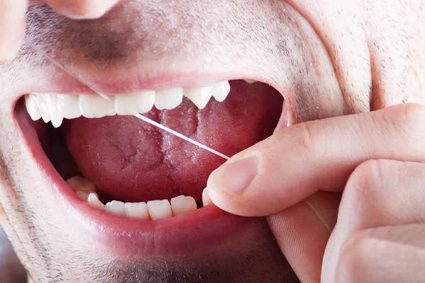 New dental floss on the background of the person. — Stock Photo, Image