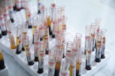 Kan ile bulanık test tüpleri