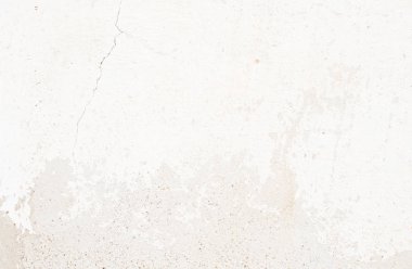 yumuşak doku alçı