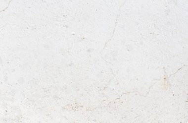 yumuşak doku alçı