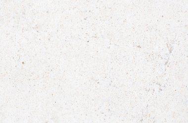 yumuşak doku alçı