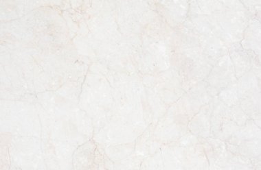 yumuşak doku alçı