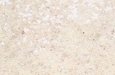 yumuşak doku alçı