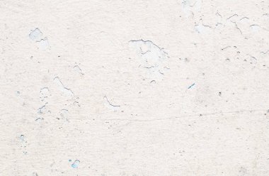 yumuşak doku alçı