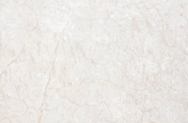 yumuşak doku alçı