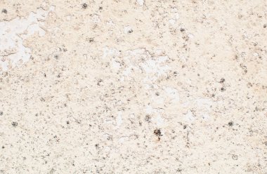 yumuşak doku alçı