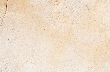 yumuşak doku alçı