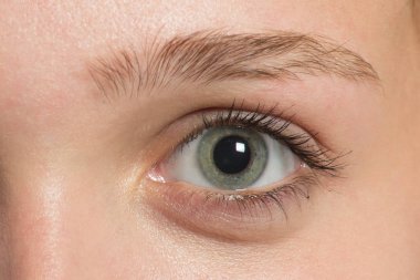 Kaş düzeltme önce