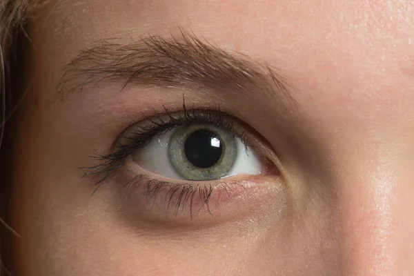 Eyebrow Before Correction — Stock Photo, Image