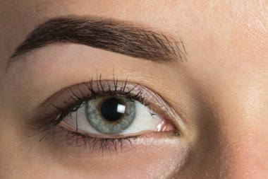 Düzeltme sonrasında büyük göz kaş